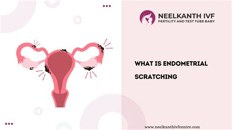 scratch test uterus|endometrial scratch ivf.